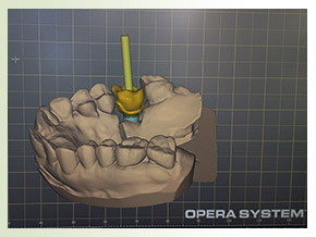 Zircon Ti-Base