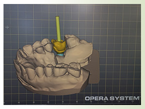 Zircon Ti-Base